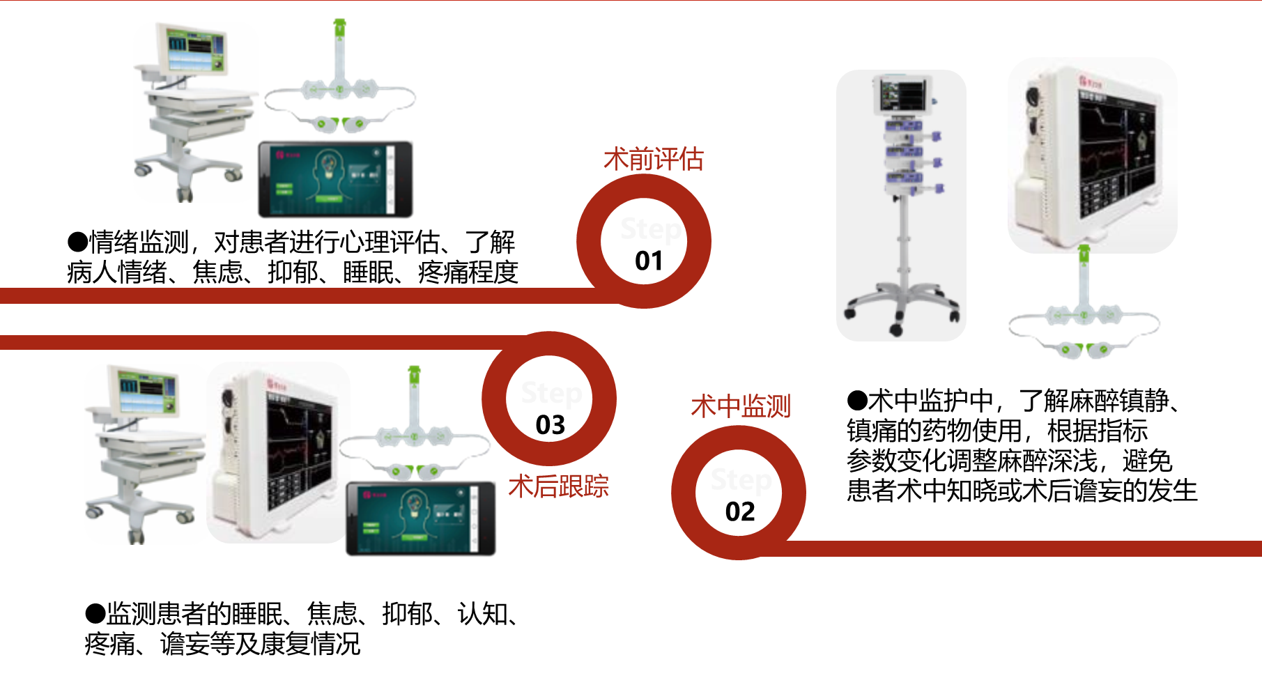 麻醉围术期大脑管理